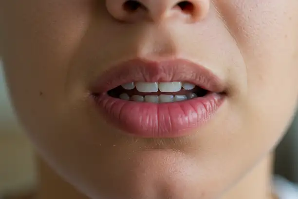 Do Allergies Cause Dry Mouth