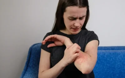 Can Allergies Cause Joint Pain?