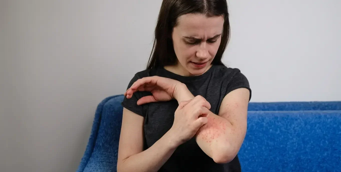 Can Allergies Cause Joint Pain